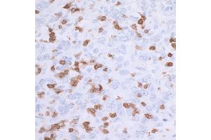 Immunohistochemistry (IHC) image for anti-CD3 epsilon (CD3E) (AA 157-207) antibody (ABIN7454035) (Rekombinanter CD3 epsilon Antikörper  (AA 157-207))