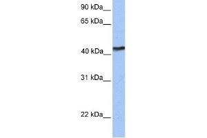 WB Suggested Anti-TMEM149 Antibody Titration:  0. (IGF-like family receptor 1 (IGFLR1) (N-Term) Antikörper)
