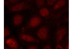 Immunofluorescence staining of methanol-fixed MCF7 cells using PKCb(phospho-Thr641) antibody.