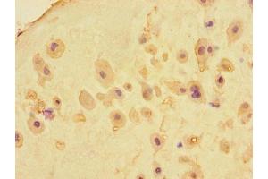 Immunohistochemistry of paraffin-embedded human placenta tissue using ABIN7159183 at dilution of 1:100 (RIKEN cDNA 4930404A10 Gene (4930404A10RIK) (AA 18-91) Antikörper)