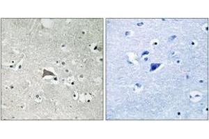 Immunohistochemistry analysis of paraffin-embedded human brain tissue, using VEGFR1 (Ab-1048) Antibody. (FLT1 Antikörper  (AA 1016-1065))