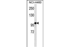Western blot analysis in NCI-H460 cell line lysates (35ug/lane). (alpha KGDHC Antikörper  (C-Term))