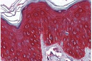 Immunohistochemistry (Formalin-fixed Paraffin-embedded Sections) (IHC (fp)) image for anti-Keratin 17 (KRT17) (AA 1-433) antibody (ABIN790550)