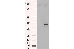 Image no. 2 for anti-E74-Like Factor 3 (Ets Domain Transcription Factor, Epithelial-Specific) (ELF3) (C-Term) antibody (ABIN374234) (ELF3 Antikörper  (C-Term))