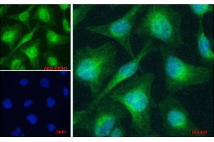 ABIN1590007 Immunofluorescence analysis of paraformaldehyde fixed HeLa cells, permeabilized with 0.