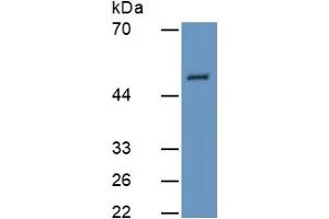 Rabbit Detection antibody from the kit in WB with Positive Control:  Sample Human Heart lysate.