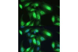 Immunofluorescence (IF) image for anti-Valosin Containing Protein (VCP) (AA 647-806) antibody (ABIN6150072)