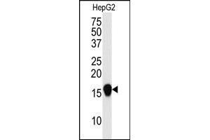 Image no. 2 for anti-Small Ubiquitin Related Modifier 4 (SUMO4) (Met55Val-Mutant) antibody (ABIN356787) (SUMO4 Antikörper  (Met55Val-Mutant))