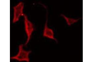 ABIN6268926 staining HeLa by IF/ICC. (ITGB1 Antikörper  (C-Term))