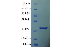 SDS-PAGE (SDS) image for Fracture Callus 1 Homolog (FXC1) (AA 1-103), (full length) protein (His-SUMO Tag) (ABIN5711983) (TIMM10B Protein (AA 1-103, full length) (His-SUMO Tag))