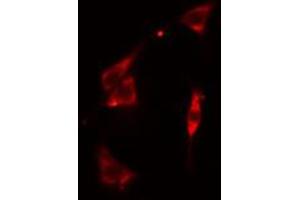 ABIN6274917 staining Hela cells by IF/ICC. (BST2 Antikörper  (Internal Region))