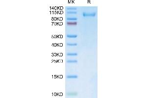 SDS-PAGE (SDS) image for LI Cadherin (AA 23-787) protein (FITC,His tag) (ABIN7274307)