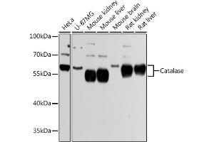 Western blot analysis of extracts of various cell lines, using Catalasealase Antibody (ABIN6133450, ABIN6137987, ABIN6137989 and ABIN6215464) at 1:3000 dilution. (Catalase Antikörper  (AA 1-225))