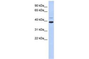 Image no. 1 for anti-Ring Finger Protein 121 (RNF121) (AA 215-264) antibody (ABIN6743182) (RNF121 Antikörper  (AA 215-264))