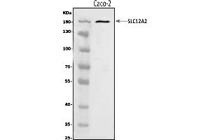 Western blot analysis of NKCC1/SLC12A2 using anti-NKCC1/SLC12A2 antibody (ABIN7602602).