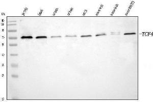 Western blot analysis of TCF4 using anti-TCF4 antibody (ABIN7600080).