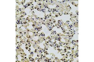 Immunohistochemistry of paraffin-embedded mouse lung using POT1 antibody (ABIN5970699) at dilution of 1/100 (40x lens). (POT1 Antikörper)