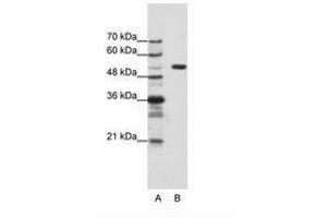 Image no. 1 for anti-Host Cell Factor C1 (VP16-Accessory Protein) (HCFC1) (AA 91-140) antibody (ABIN203129) (HCFC1 Antikörper  (AA 91-140))