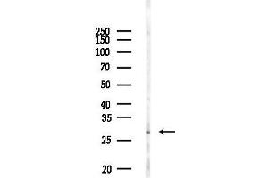anti-Interleukin 17D (IL17D) antibody