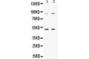 Western blot analysis of MAP3K8 expression in rat brain extract ( Lane 1) and HELA whole cell lysates ( Lane 2). (MAP3K8 Antikörper  (AA 9-193))