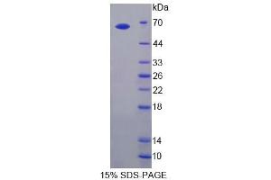 SDS-PAGE analysis of Rat TLR3 Protein. (TLR3 Protein)