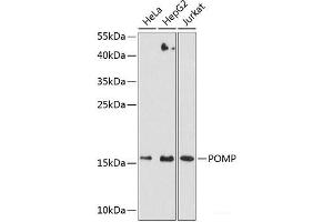 Western blot analysis of extracts of various cell lines using POMP Polyclonal Antibody at dilution of 1:3000. (POMP Antikörper)