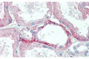 Immunohistochemistry (IHC) image for anti-Transmembrane Protein 27 (TMEM27) (AA 12-222) antibody (ABIN7436798)