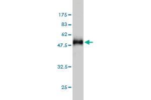 Western Blot detection against Immunogen (49. (HYI Antikörper  (AA 1-217))