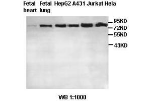 Image no. 2 for anti-MRE11 Meiotic Recombination 11 Homolog A (S. Cerevisiae) (MRE11A) antibody (ABIN791214) (Mre11 Antikörper)