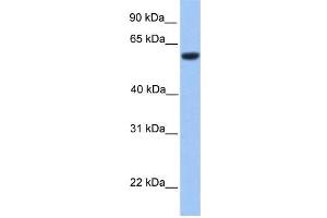 Human Brain; WB Suggested Anti-ZNF545 Antibody Titration: 0. (Zinc finger protein 82 homolog (ZFP82) (C-Term) Antikörper)