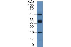 Detection of ICAM2 in Human Hela cell lysate using Polyclonal Antibody to Intercellular Adhesion Molecule 2 (ICAM2) (ICAM2 Antikörper  (AA 27-248))