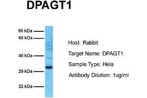 Host: Rabbit Target Name: DPAGT1 Sample Tissue: Human Hela Antibody Dilution: 1. (DPAGT1 Antikörper  (C-Term))