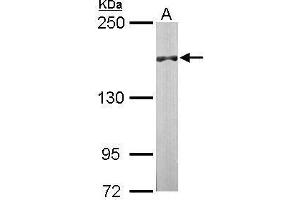 DIP2B anticorps  (C-Term)