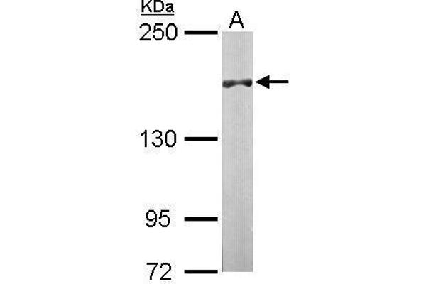 DIP2B antibody  (C-Term)