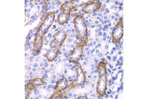Immunohistochemistry of paraffin-embedded rat kidney using ARRB1 antibody at dilution of 1:100 (400x lens). (beta Arrestin 1 Antikörper)