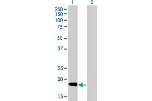 Western Blot analysis of SLC11A1 expression in transfected 293T cell line by SLC11A1 MaxPab polyclonal antibody. (SLC11A1 Antikörper  (AA 1-178))