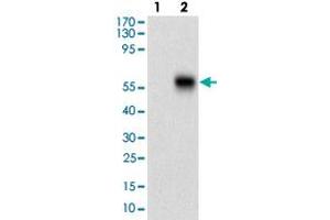 Western blot analysis of Lane 1: Negative control [HEK293 cell lysate]; Lane 2: Over-expression lysate [CAMK2G (AA: 322-481)-hIgGFc transfected HEK293 cells] with CAMK2G monoclonal antibody, clone 8G10C1  at 1:500-1:2000 dilution.