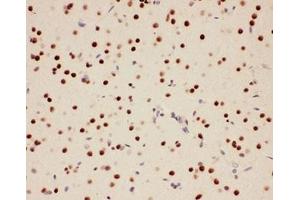 IHC-P: PIAS1 antibody testing of rat brain tissue