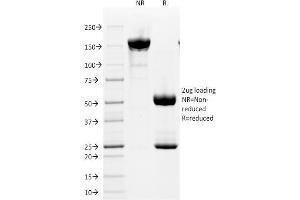 SDS-PAGE Analysis Purified CD2 Mouse Monoclonal Antibody (HuLy-m1). (CD2 Antikörper)