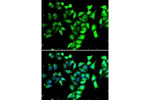 Immunofluorescence analysis of A549 cells using FKBP8 antibody (ABIN5974260). (FKBP8 Antikörper)