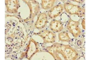 Immunohistochemistry of paraffin-embedded human kidney tissue using ABIN7145636 at dilution of 1:100
