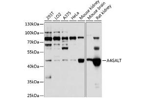 Western blot analysis of extracts of various cell lines, using GALT antibody (ABIN6131973, ABIN6136304, ABIN6136305 and ABIN6224802) at 1:1000 dilution. (A4GALT Antikörper  (AA 244-353))