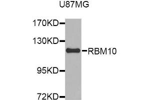 Western blot analysis of extracts of U87MG cell line, using RBM10 antibody. (RBM10 Antikörper  (AA 1-180))