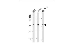 All lanes : Anti-HIF1AN Antibody (C-term) at 1:4000 dilution Lane 1: 293 whole cell lysate Lane 2: Jurkat whole cell lysate Lane 3: ZR-75-1 whole cell lysate Lysates/proteins at 20 μg per lane. (HIF1AN Antikörper  (AA 1-349))