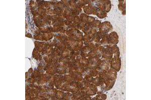 Immunohistochemical staining (Formalin-fixed paraffin-embedded sections) of human pancreas with RPS29 polyclonal antibody  shows strong cytoplasmic positivity in exocrine glandular cells.