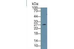 Western Blot; Sample: Mouse Serum; Primary Ab: 1µg/ml Rabbit Anti-Mouse CLTA Antibody Second Ab: 0. (CLTA Antikörper  (AA 5-234))