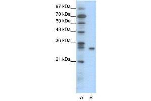 WB Suggested Anti-NFKBIB  Antibody Titration: 0. (NFKBIB Antikörper  (N-Term))