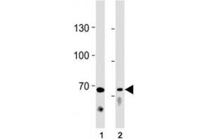 TICAM1 antibody western blot analysis in (1) Ramos cell line and (2) mouse liver tissue lysate. (TICAM1 Antikörper  (AA 115-143))