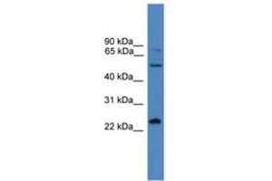 Image no. 1 for anti-SMAD, Mothers Against DPP Homolog 2 (SMAD2) (C-Term) antibody (ABIN6745339) (SMAD2 Antikörper  (C-Term))
