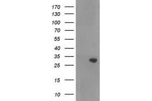 Western Blotting (WB) image for anti-Ras Association (RalGDS/AF-6) Domain Family Member 5 (RASSF5) antibody (ABIN1500615) (RASSF5 Antikörper)
